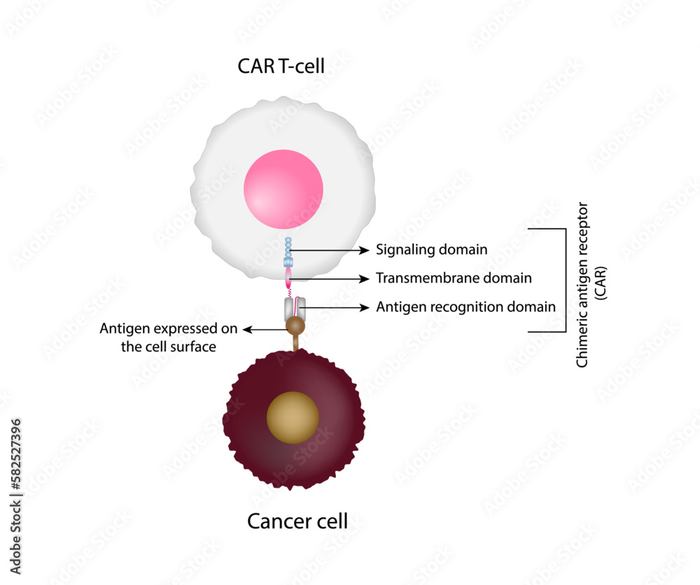 CAR Tcell therapy and Cancer treatment . Chimeric antigen receptor T