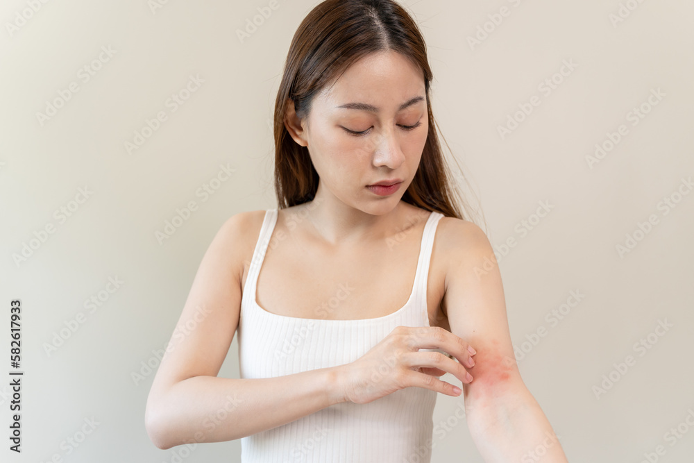 Sensitive skin allergic concept, Woman itching on her arm have a red rash from allergy symptom and from scratching. Sensitive skin allergic concept, Woman itching on her arm have a red rash from allergy symptom and from scratching.