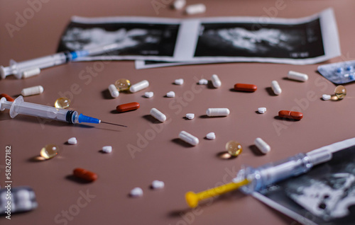 The abbreviation ECO is lined with wooden letters on a pink background. In vitro injection pen, tablets. Syringe with thin huge. ECO concept. Infertility. Ultrasound. Hormonal drugs for stimulation