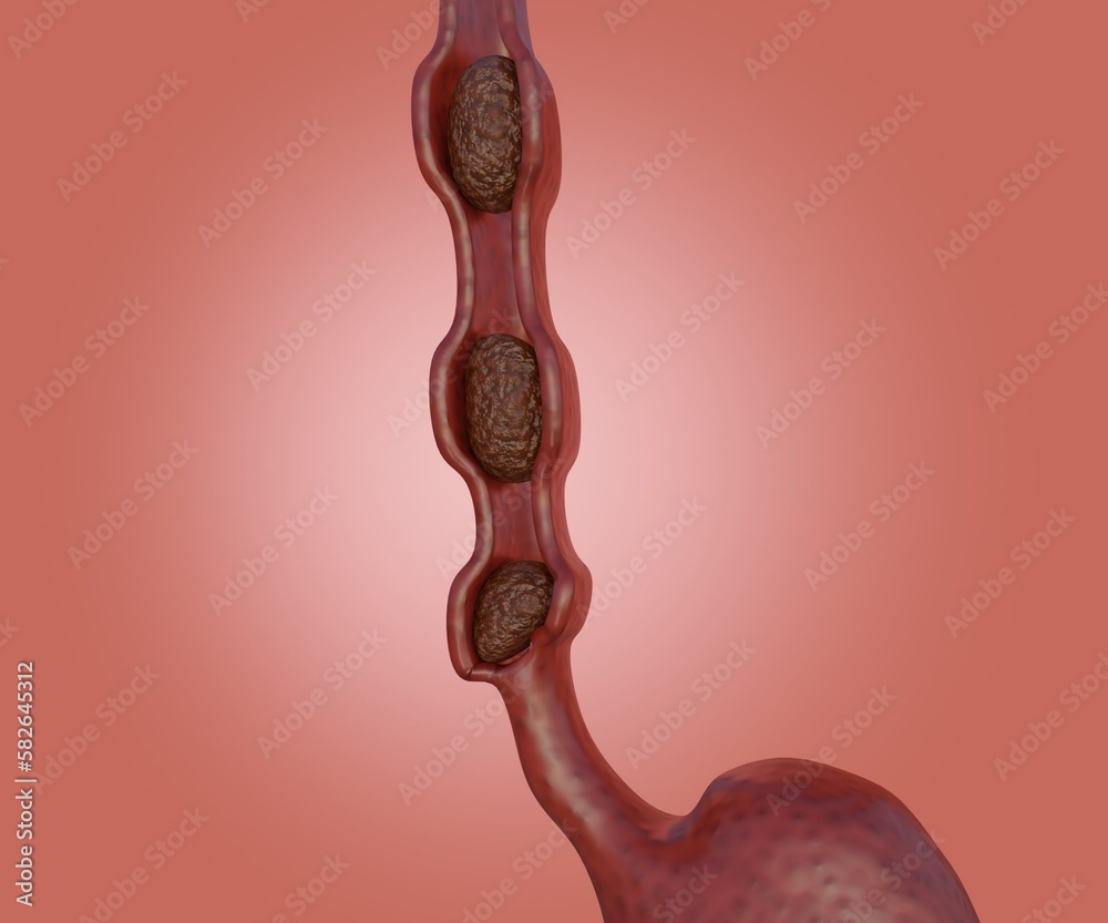 Peristalsis is a series of wavelike muscle contractions that move food