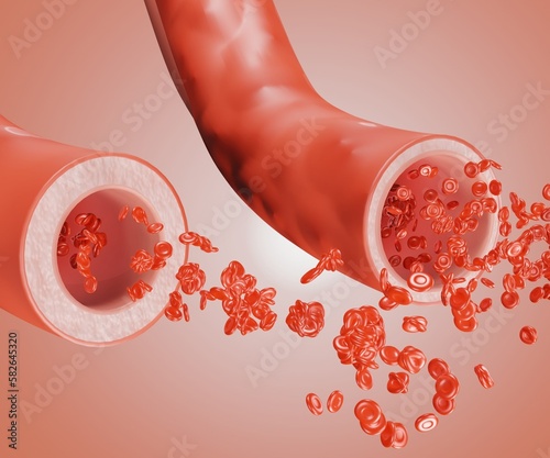 normal blood vessel and widening blood vessels, Vasodilation, also known as vasorelaxation, is the widening of blood vessels 3d rendering photo