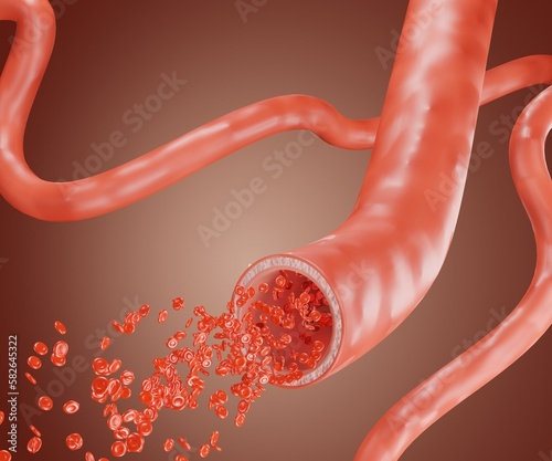 Canvas Print bursting blood vessel and red blood cells scattered in the white background 3d r