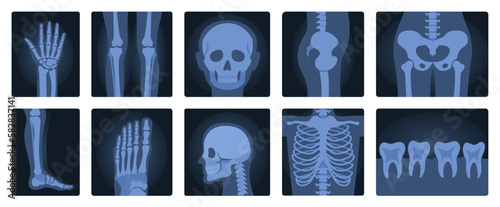 Xrays films of human body set, radiography and anatomy vector illustration. Cartoon isolated medical roentgen scans with silhouettes of bones of skeleton, joint and articulation of legs and hands