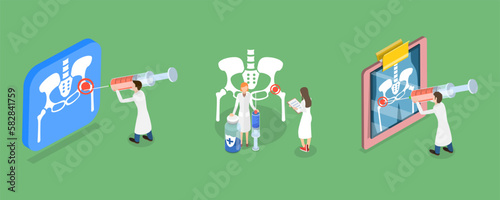 3D Isometric Flat Vector Conceptual Illustration of Hip Joint Cortisone Injection, Bones of the Pelvis and Hip, Human Anatomy