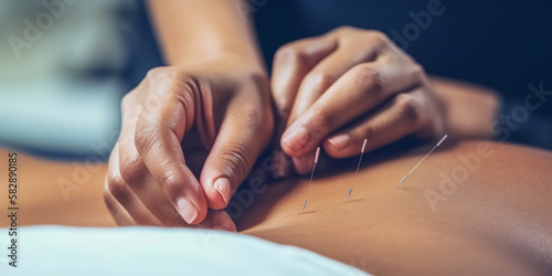 The doctor sticks needles into the girl's body on the acupuncture. digital ai art
