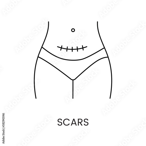 Scars line icon in vector, c-section scar illustration photo