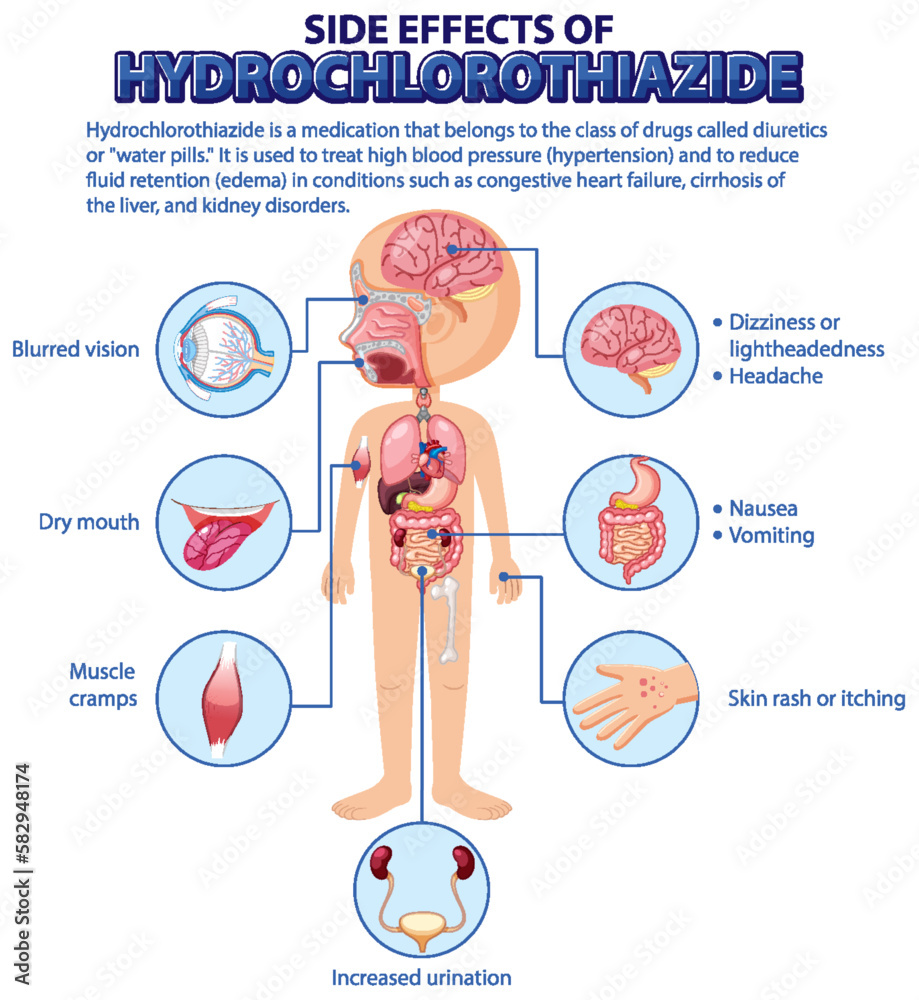 Human anatomy diagram cartoon style of hydrochlorothiazide side effects