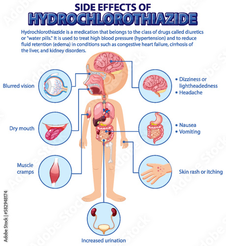 Human anatomy diagram cartoon style of hydrochlorothiazide side effects
