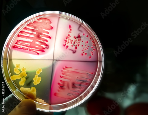 Bacteria colony on culture media plate, stool culture photo