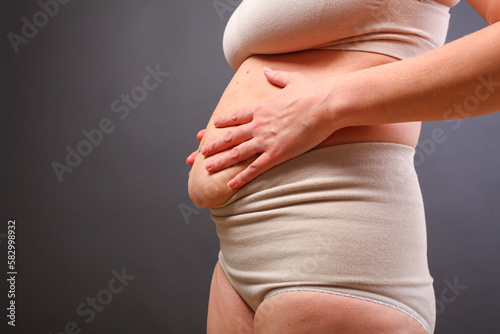 young woman in postpartum corrective tightening underwear shows her  overweight. The girl squeezes her excess belly fat with her hands after  childbirth Stock Photo
