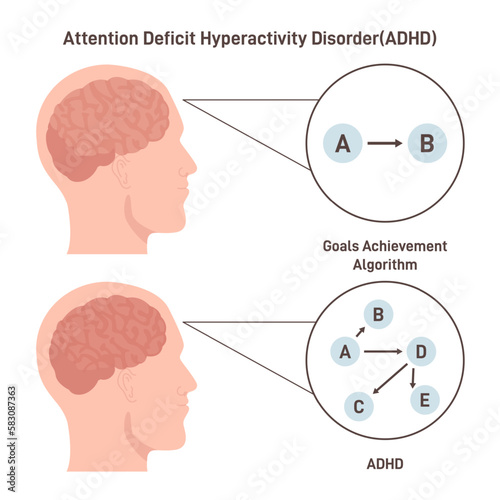 ADHD brain concept. Attention deficit hyperactivity disorder way