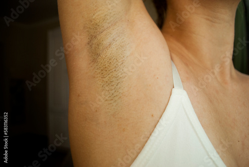 Hair on a woman s armpit. Concept of body naturalness self love. Hair removal.Armpit stubble. 