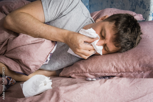 Ill caucasian man in bed with virus, flu or cold blowing running nose surrounded by used tissues
