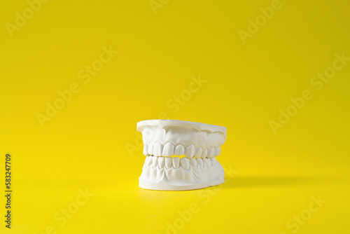 Jaw. Plaster model of the upper and lower jaw. Tooth model. High quality photo.