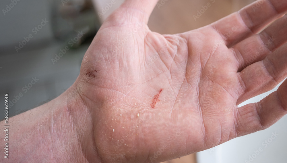 Fototapeta premium A cut on a man's palm in close-up. Household skin damage with a sharp cutting object, first aid