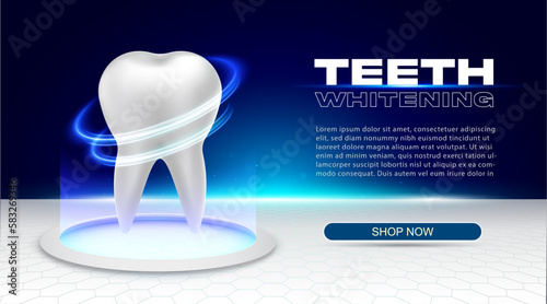 Laser teeth whitening futuristic style banner. White tooth in technological room on round pedestal illuminated by blue light. Artificial tooth implant concept. Innovative dentistry. 3D vector template