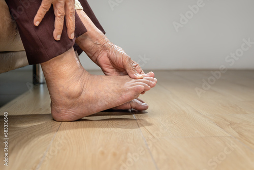 Senior woman massage foot with painful swollen gout inflammation © toa555