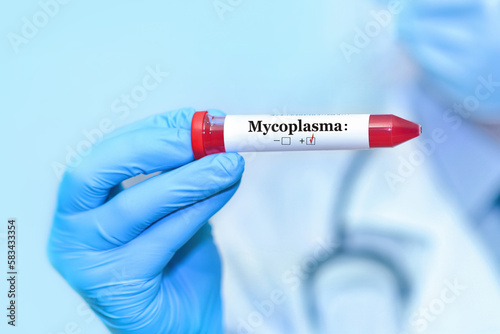 Doctor holding a test blood sample tube positive with Mycoplasma test on the background of medical test tubes with analyzes. photo