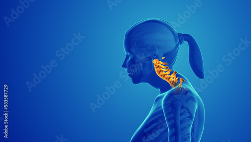 Cervical postural syndrome or neck discomfort