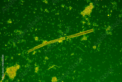 Microscopic view of various species of planktonic freshwater algae. Rheinberg illumination. photo