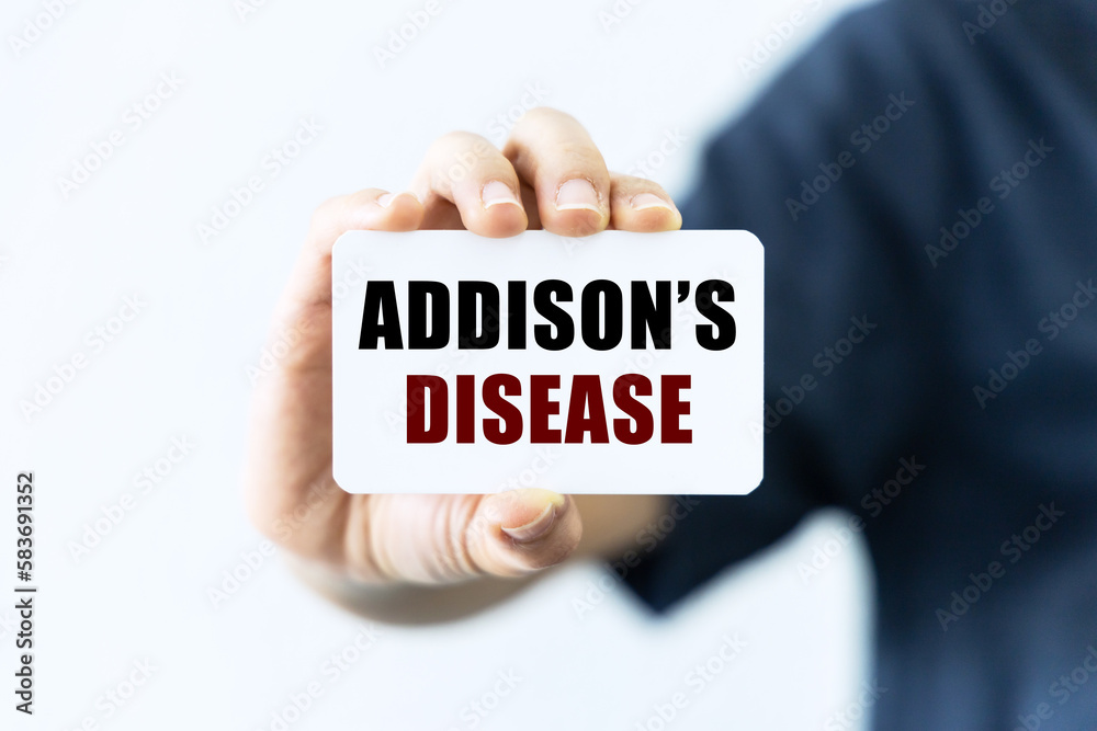 Addison's disease text on blank business card being held by a woman's hand with blurred background. Business concept about Addison's disease. Addison's disease text on blank business card being held by a woman's hand with blurred background. Business concept about Addison's disease.