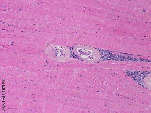 Trichinella spiralis,  parasite, encyst larva, worm, nematode