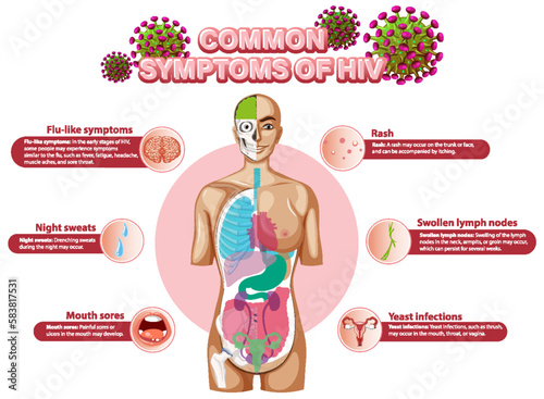 Informative poster of common symptoms of HIV