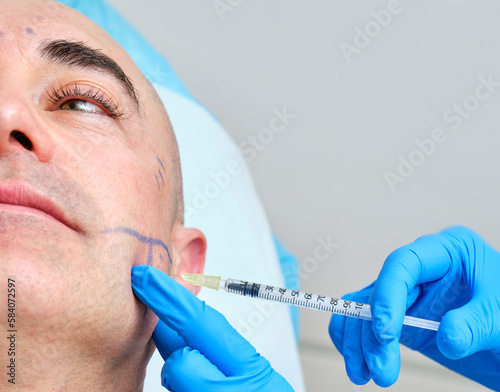 gloved hands injecting botulinum toxin into a man's face for treatment of bruxism