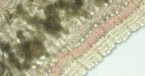 Leech family Erpobdellidae under a microscope, order Arhynchobdellida. Possibly genus Erpobdella sp. Visible muscle contraction, blood flow and structure of body surface is visible photo