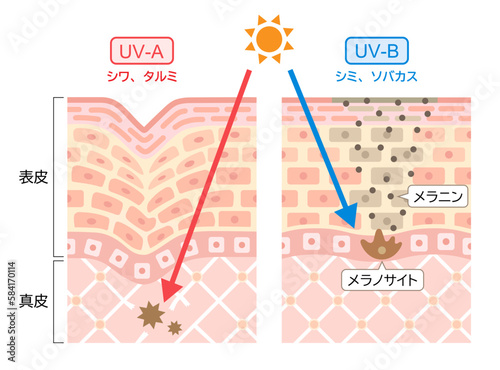 紫外線　UV-AとUV-Bの違い　肌の断面図　