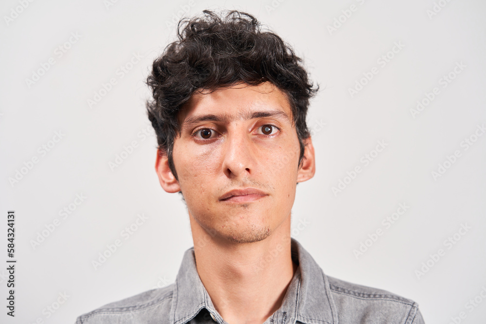 Young man with cataract in his eye looking seriously at the camera. Young man with cataract in his eye looking seriously at the camera.