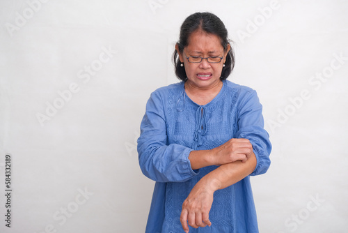 A woman scratches her itchy arm. photo