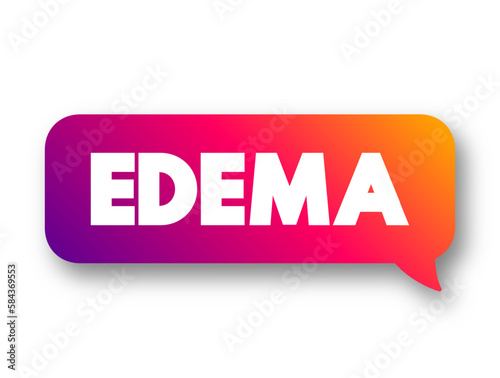 Edema is swelling caused by excess fluid trapped in your body's tissues, text concept message bubble