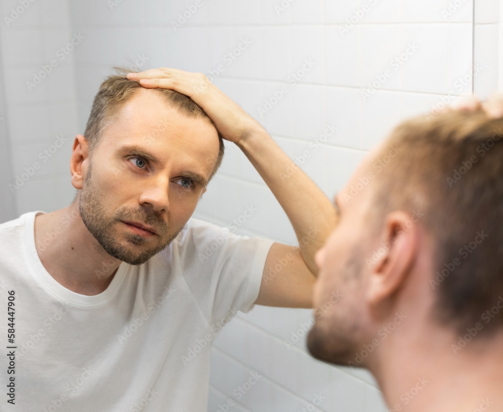 Obraz premium Middle aged caucasian white man with a short beard looks at his hair in the mirror in the bathroom and worried about balding. The concept of the problem of male hair loss, early baldness and alopecia