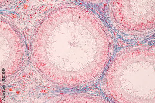 Anatomy and Histological Epididymis and Testis human cells under microscope.
