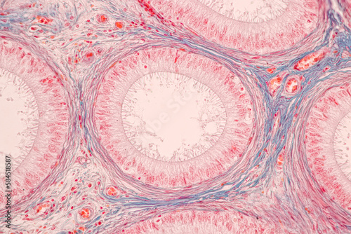 Anatomy and Histological Epididymis and Testis human cells under microscope. photo