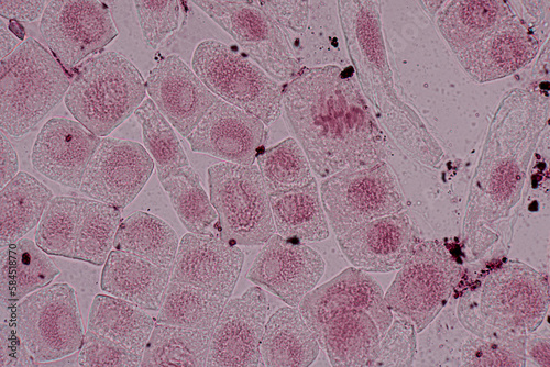 Root tip of Onion and Mitosis cell in the Root tip of Onion under a microscope. 