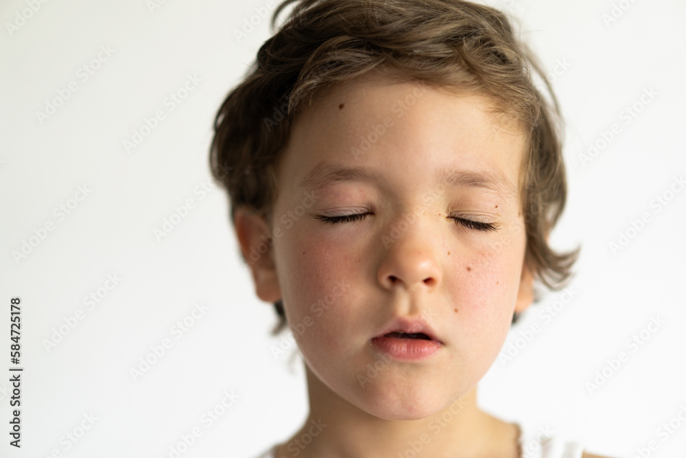 The boy was swollen from allergies. Allergy from pollen or food. Allergy concept The boy was swollen from allergies. Allergy from pollen or food. Allergy concept