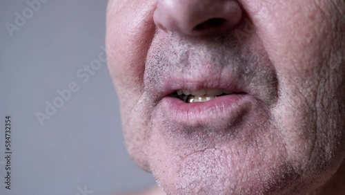 Close up, Smiling Elderly Male Pensioner with False Dentures and Golden Teeth. Wrinkled, unshaven face of an old man with white dental implants, and an artificial upper jaw in mouth. Part of face.