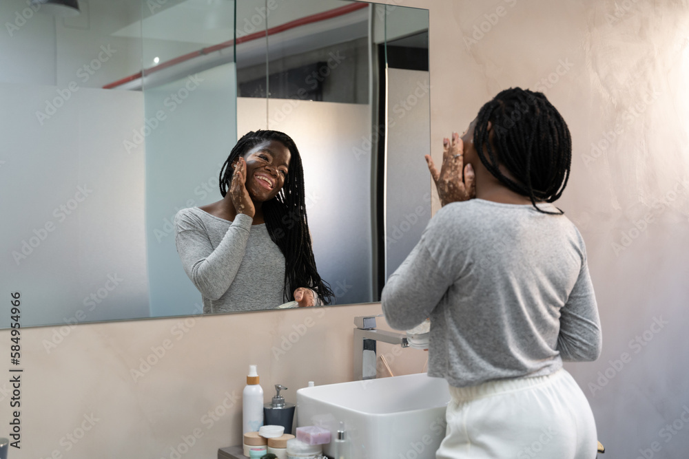 Skin care vitiligo Skin care vitiligo