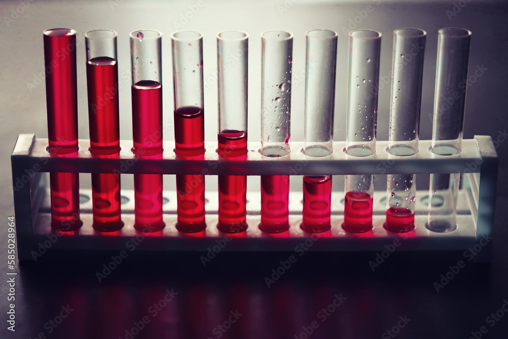 Microscopic examination of blood. Test tubes with red liquid on the laboratory table.