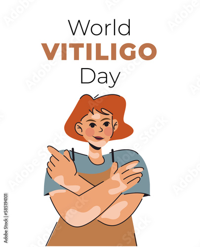 girl with vitiligo. Love yourself. Banner for international Vitiligo Day. White background.