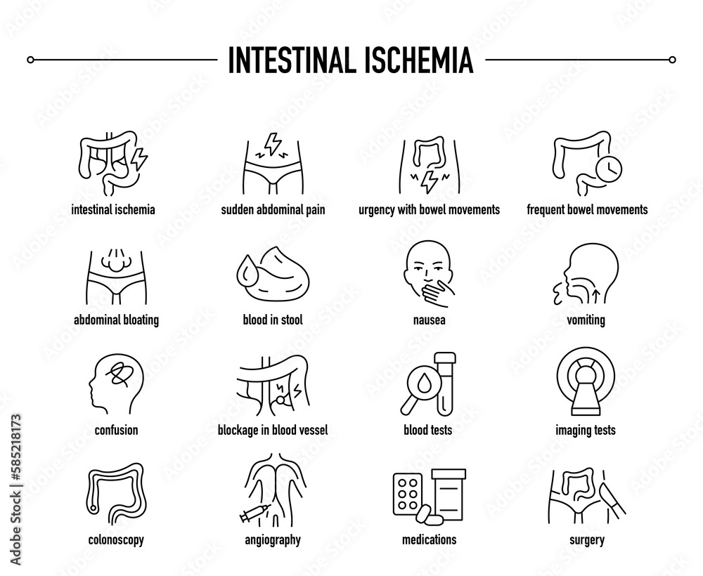 Intestinal Ischemia symptoms, diagnostic and treatment vector icon set. Line editable medical icons. Intestinal Ischemia symptoms, diagnostic and treatment vector icon set. Line editable medical icons.