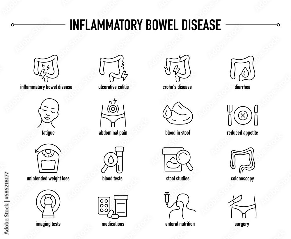 inflammatory-bowel-disease-symptoms-diagnostic-and-treatment-vector
