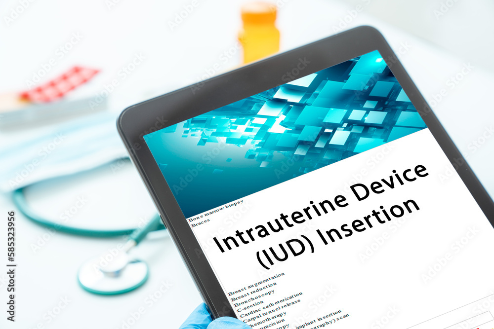 Foto Stock Intrauterine Device (IUD) Insertion medical procedures A