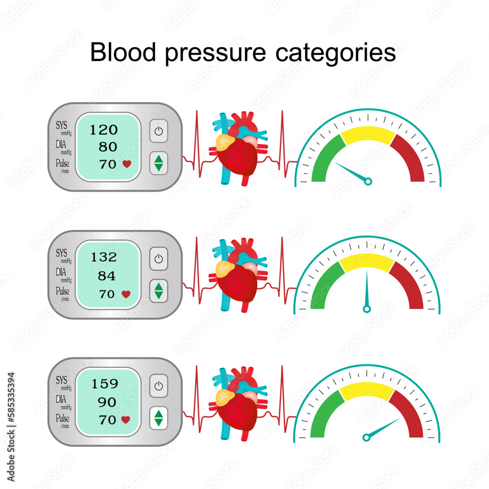 Blood pressure monitor with heart and speedometer isolated on white background, high blood pressure, hypertension disease, medical health care, vector, illustration.