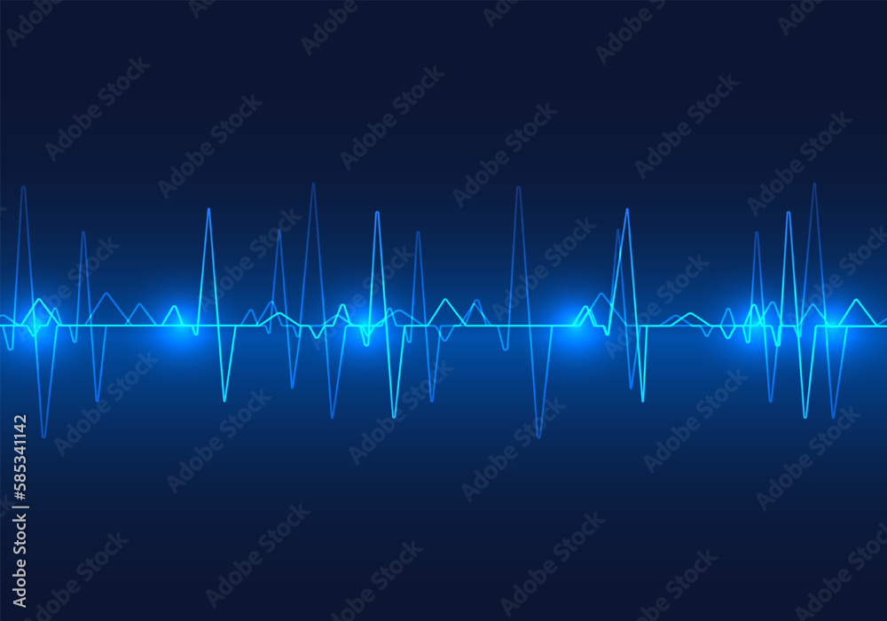 Overlapping heart waves It is a medical technology used to check the heart's rhythm changes. It is a background that can be used for medical communication so that the general public can understand. Overlapping heart waves It is a medical technology used to check the heart's rhythm changes. It is a background that can be used for medical communication so that the general public can understand.