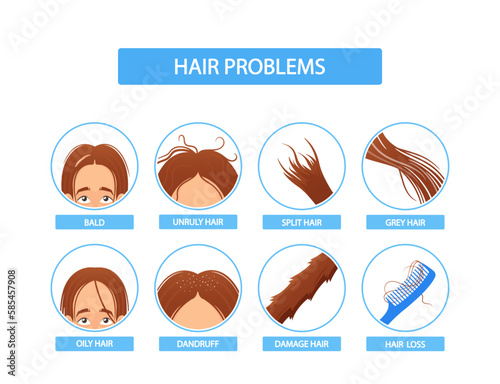 Women Hair Problem Infographics Icons. Female Character with Bald, Unduly, Split, Oily, Grey Hair, Dandruff or Hair Loss