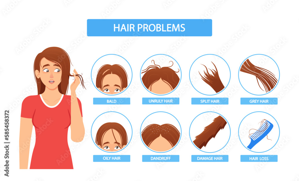 Women Hair Problem Infographics. Female with Bald, Unduly, Split, Oily, Damage, Grey Hair, Dandruff and Hair Loss Women Hair Problem Infographics. Female with Bald, Unduly, Split, Oily, Damage, Grey Hair, Dandruff and Hair Loss