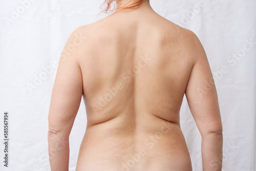 Nude back of fat woman with folds on light background. body of an overweight middle aged woman. Surgery, liposuction, weight loss.